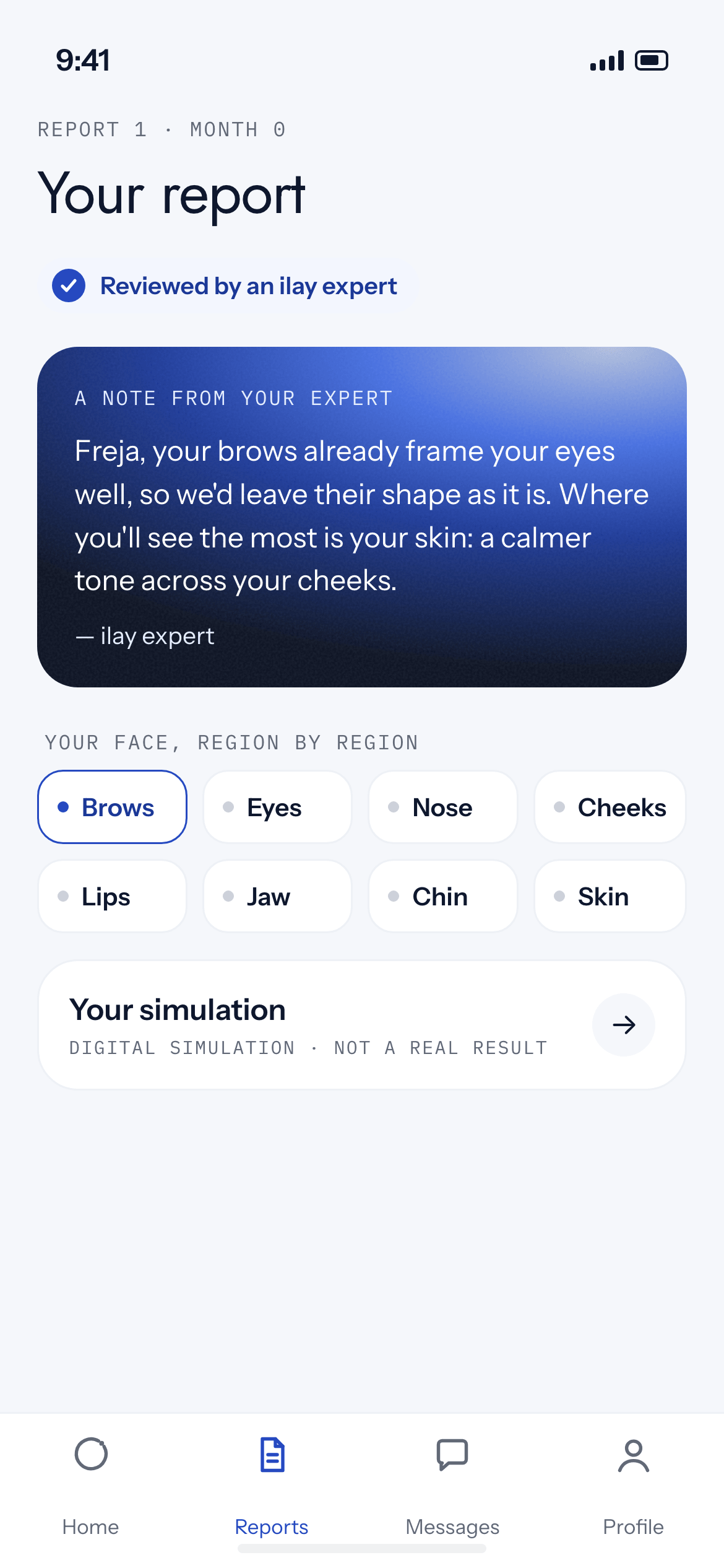 A phone showing an ilay report: the note from the expert and the regions of the face